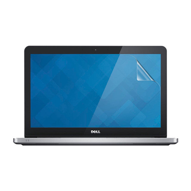 9eight5 Hydrogel screen protector for Dell Inspiron 15 7579, showing the clear, flexible film fitting over the laptop screen.